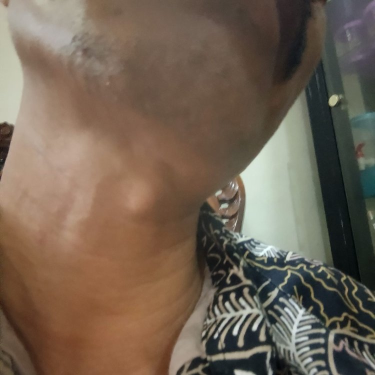 Dampak Penelusuran Miras Ilegal Berujung Wartawan Jadi Korban penganiayaan, Pengeroyokan Di Wilayah Kramatwatu Serang Banten.